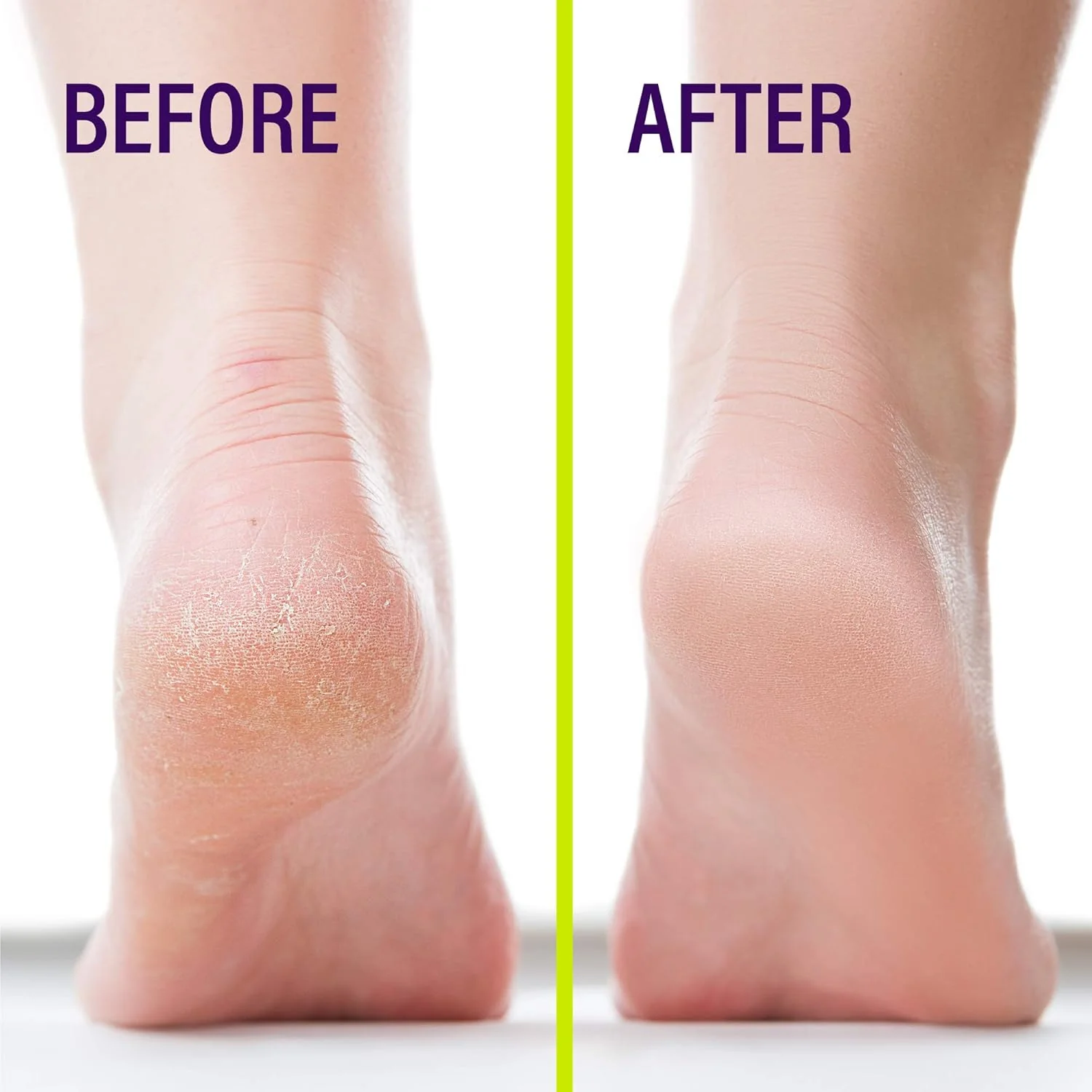 Heel Seal - Liquid Skin Protectant for Cracked Heels - Image 6